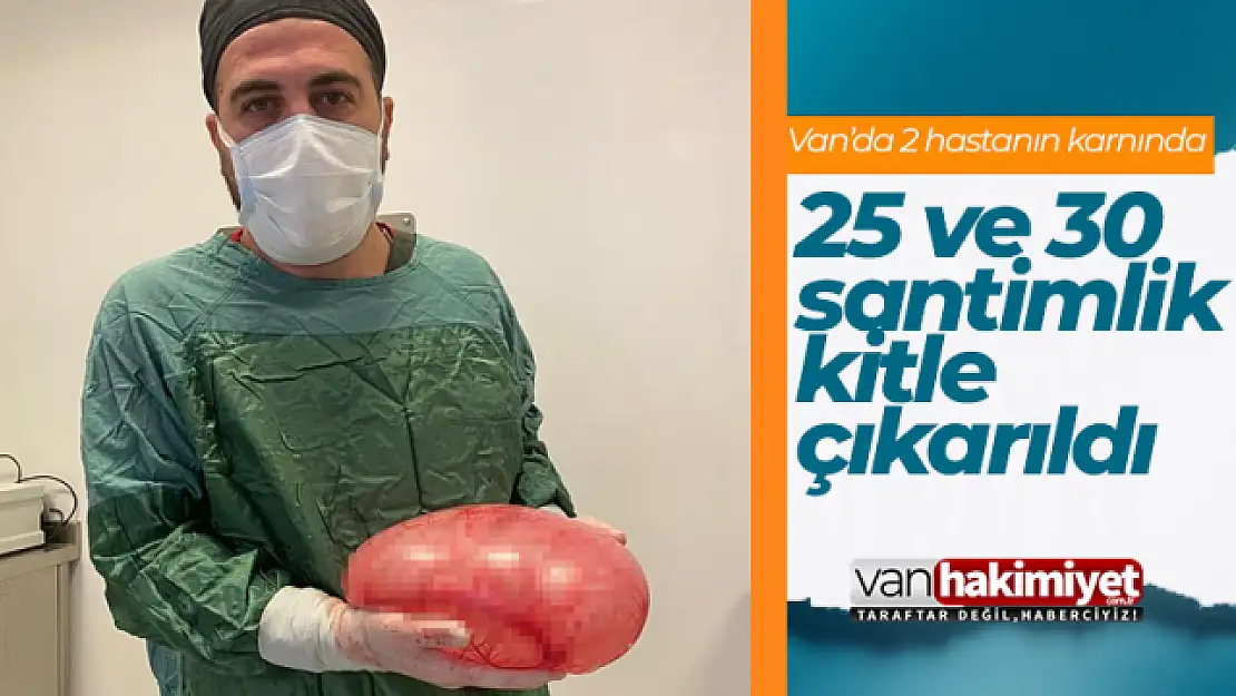 Van'da 2 hastanın karnından 25 ve 30 santimlik kitle çıkarıldı